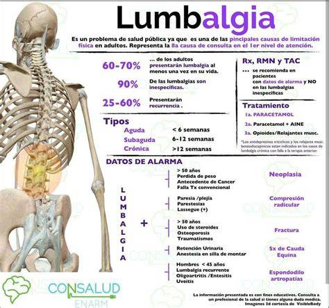 infografía sobre anatomía de la espalda y lumbalgia