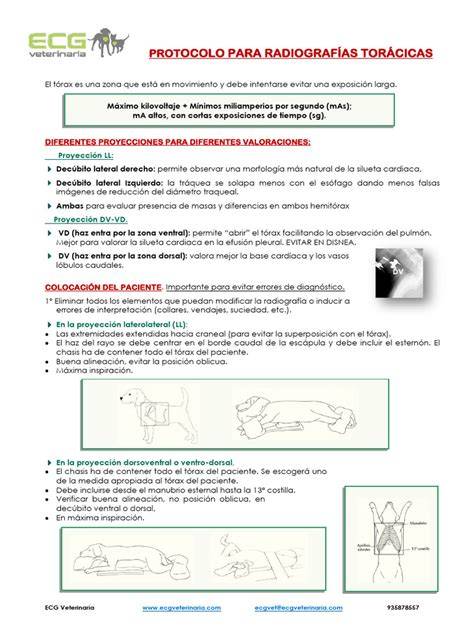 Radiografías torácicas y dosis comparadas