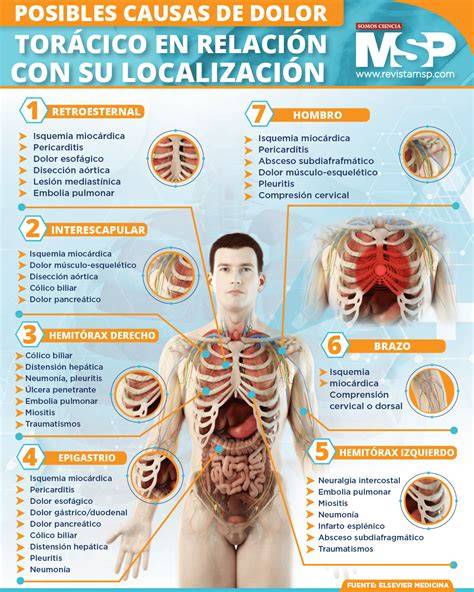 Gráfica de relación entre yoga y dolor torácico