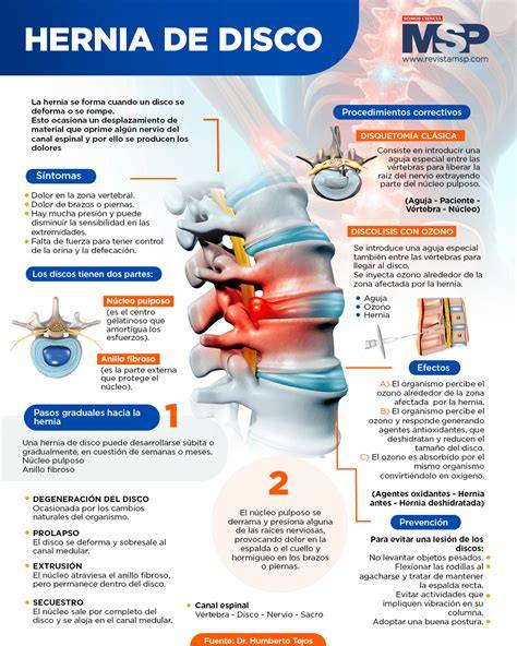 infografía beneficios yoga hernia disco