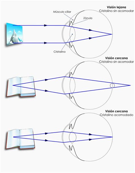 diagrama de acomodación ocular